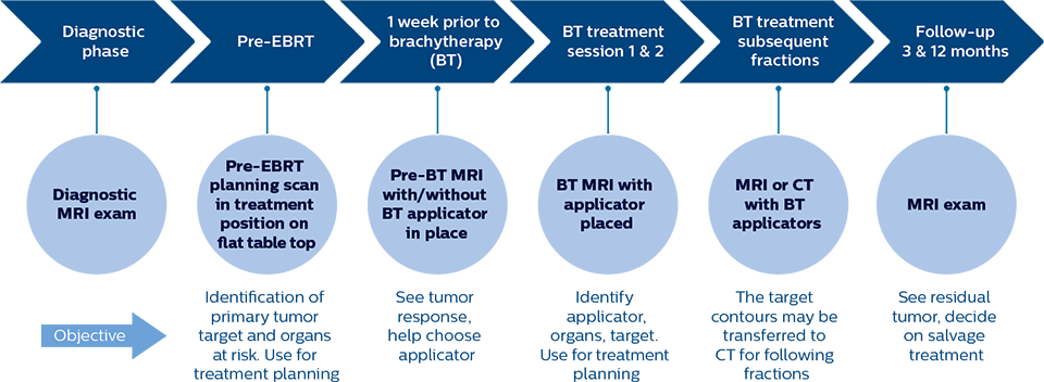 At Aarhus, MRI plays a role across the entire patient trajectory for cervical cancer radiation therapy