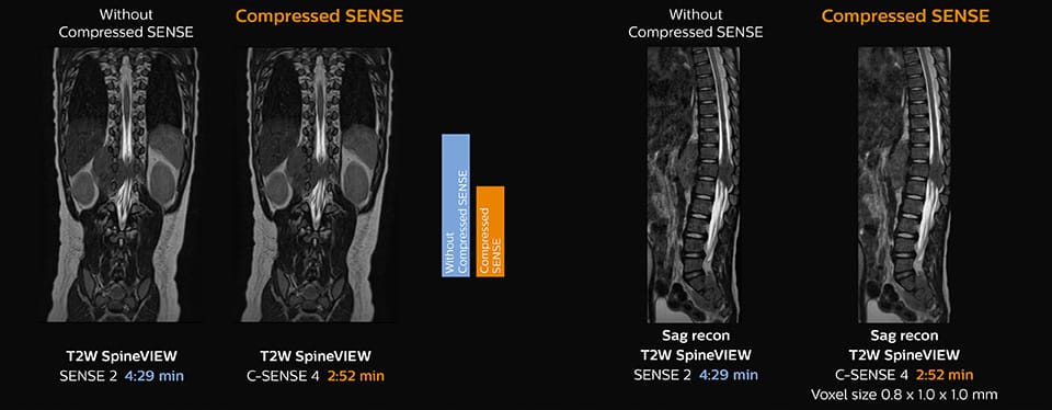 clinical image pediatric spine desktop