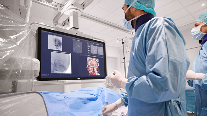 How Philips is enabling the future of stroke care