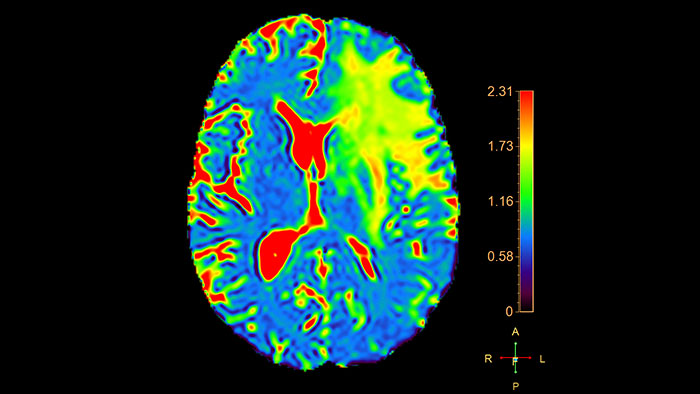 magnetic resonance diffusion